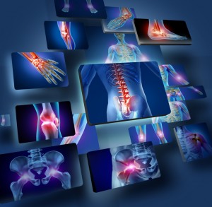 osteoporosis symptoms concept with the skeleton